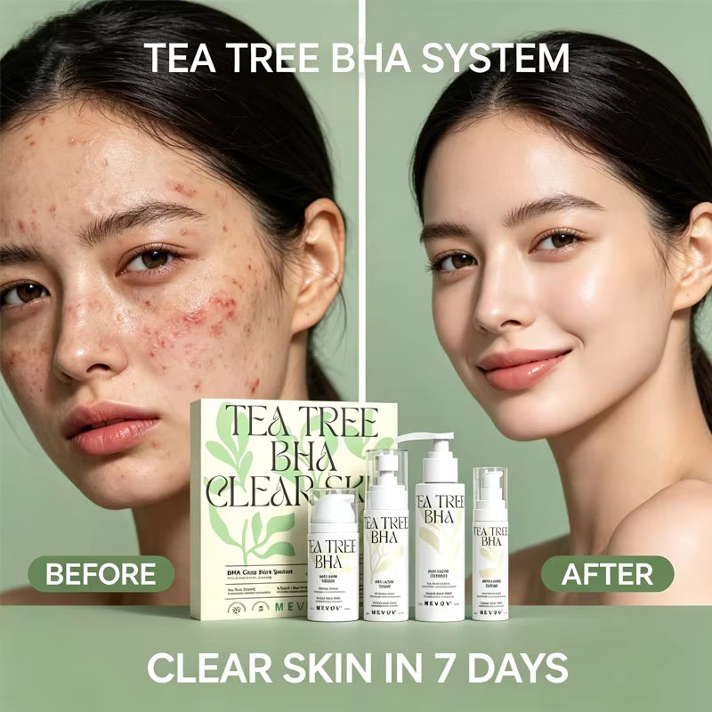 Private Label Salicylic Acid BHA Tea Tree Oil Control Cleanser Toner Acne Cream and Serum anti Acne Skincare Set