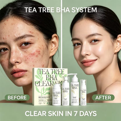 Private Label Salicylic Acid BHA Tea Tree Oil Control Cleanser Toner Acne Cream and Serum anti Acne Skincare Set