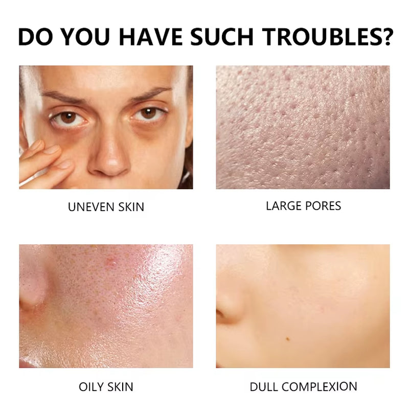 Private Label Oil Control Reduce Enlarged Pores & Dark Spots Promotes Clear Skin Tone Azelaic Acid Serum